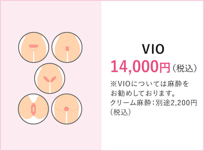 VIO 14,000円（税込）