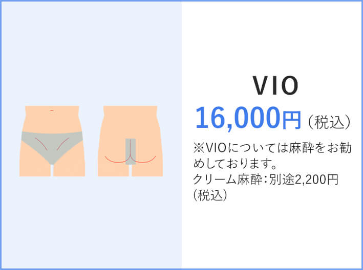 VIO 16,000円（税込）