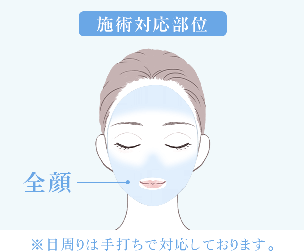 施術対応部位 全顔