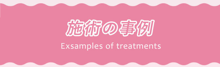 ヒアルロン酸注入はこんな悩みを即日解消します