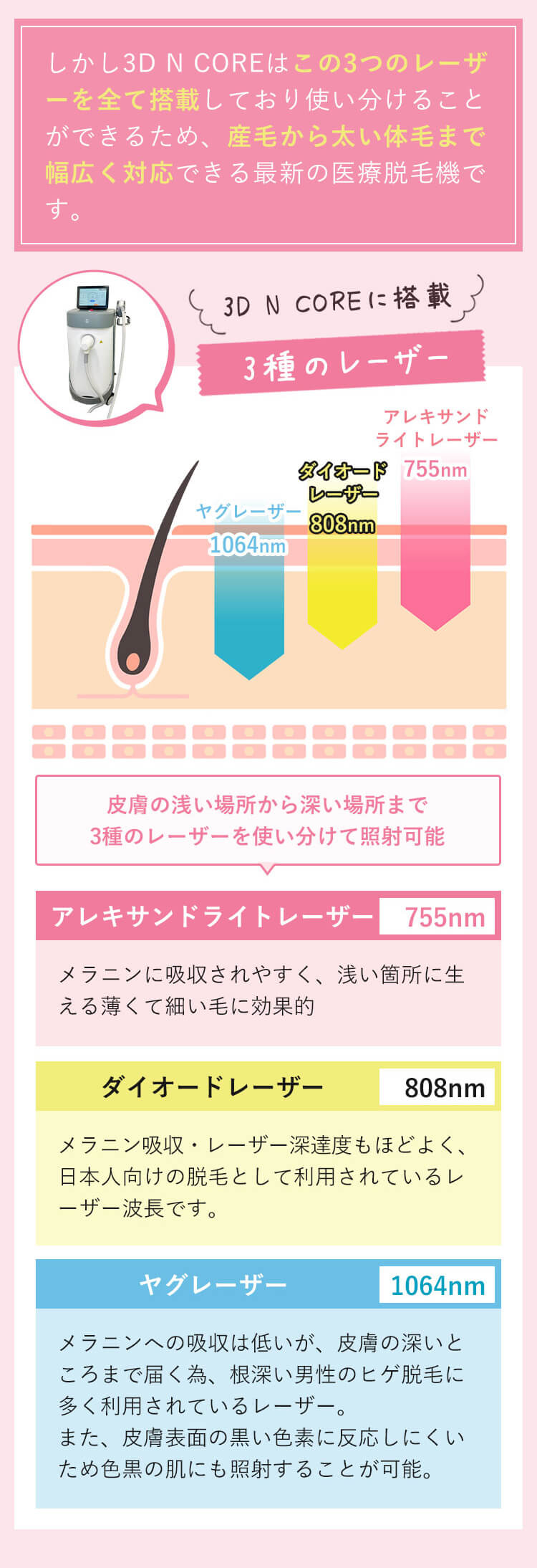 3D N COREに搭載 3種のレーザー