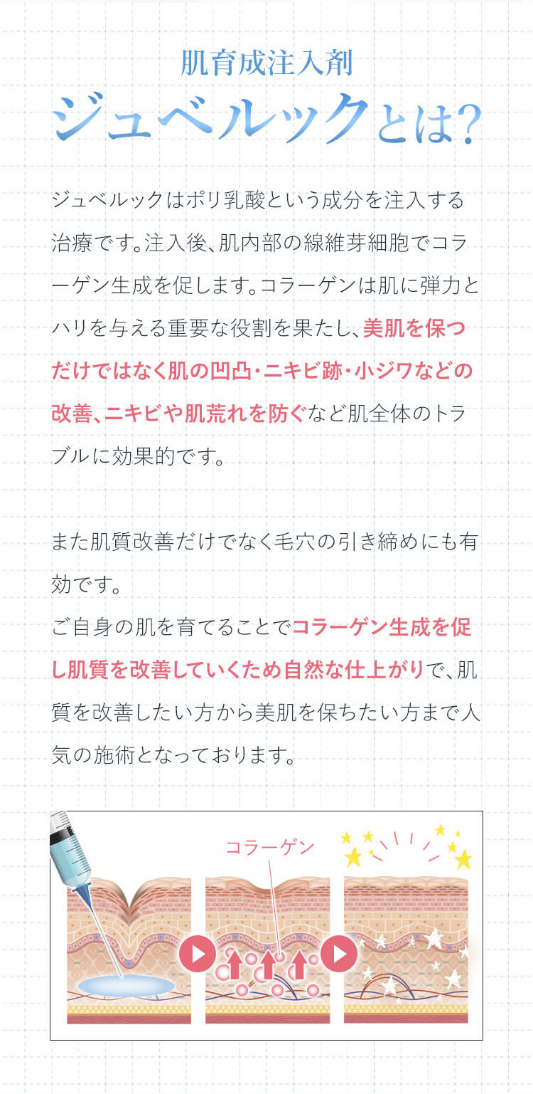 肌育成注入材ジュベルックとは？